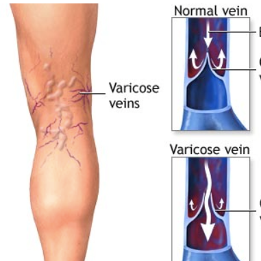 VenusKardia's profile picture. Serving greater Columbus specializing in varicose and spider vein treatments using the latest technology for a happier, healthier you! (614) 336-4110.