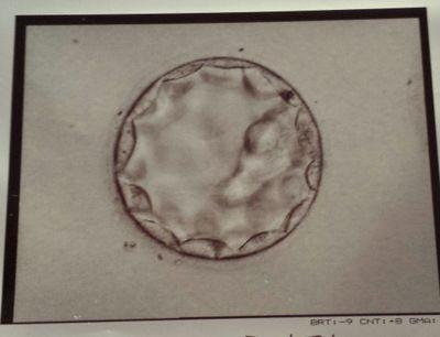 Husband. Father. Policeman. DD born 05/07, ttc #2 for 3yrs, mc 2013, IVF#1 2014 - BFP May'14. DS born 02/15 via C/Section. 1 x ❄ - hmmmmm, what to do??