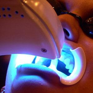 Opening in Wrexham soon. Lazer Tooth Whitening. Prices start from £59.99 for one hour session. Contact us on 07044 050 416