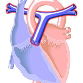 Twitterbot posting PubMed #pulmonaryhypertension papers https://t.co/BeTo9sLJM3 #PH