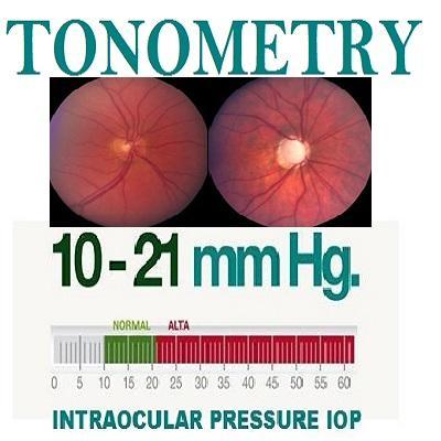 TONOMETRY About INTRAOCULAR EYE Pressure, IOP, Glaucoma, Blindness http://t.co/dgCPGrWZ9e #tonometry optometry ophthalmology vision health eyecare tonometer