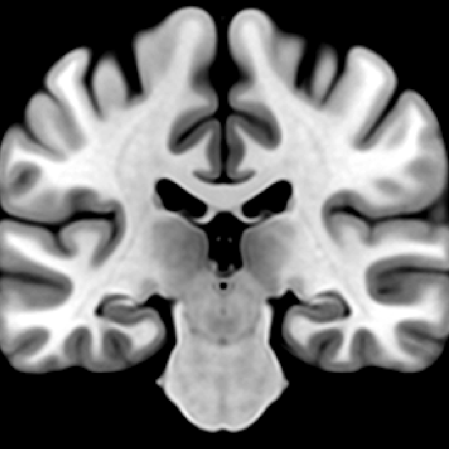 Neuroimager, neuroscientist & occasional phrenologist