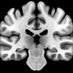 James Cole (@jamescole_neuro) Twitter profile photo James Cole (@jamescole_neuro) Twitter profile photo
