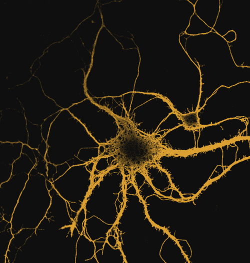 jordantflick's profile picture. Neurons and bagels. Don't forget the glia or the cream cheese.
