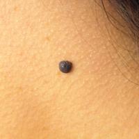 Melanoma (@_melanoma) 's Twitter Profile