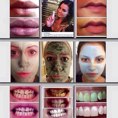 ✨ Suitable for men & women ✨ ✨ Teeth Whitening, Face Care, Body Care, And much more ✨ ✨ Message me for more details ✨