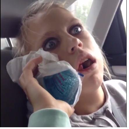 Post after wisdom teeth took out, Videos that will make you laugh your ass off! Tweet us your vid : @WisdomTeethGone