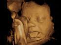 1-800-Sonogram is the Nationwide leader in 3d/4d Prenatal Ultrasounds. Find a Sonogram center near you at http://t.co/lMfBERK40V