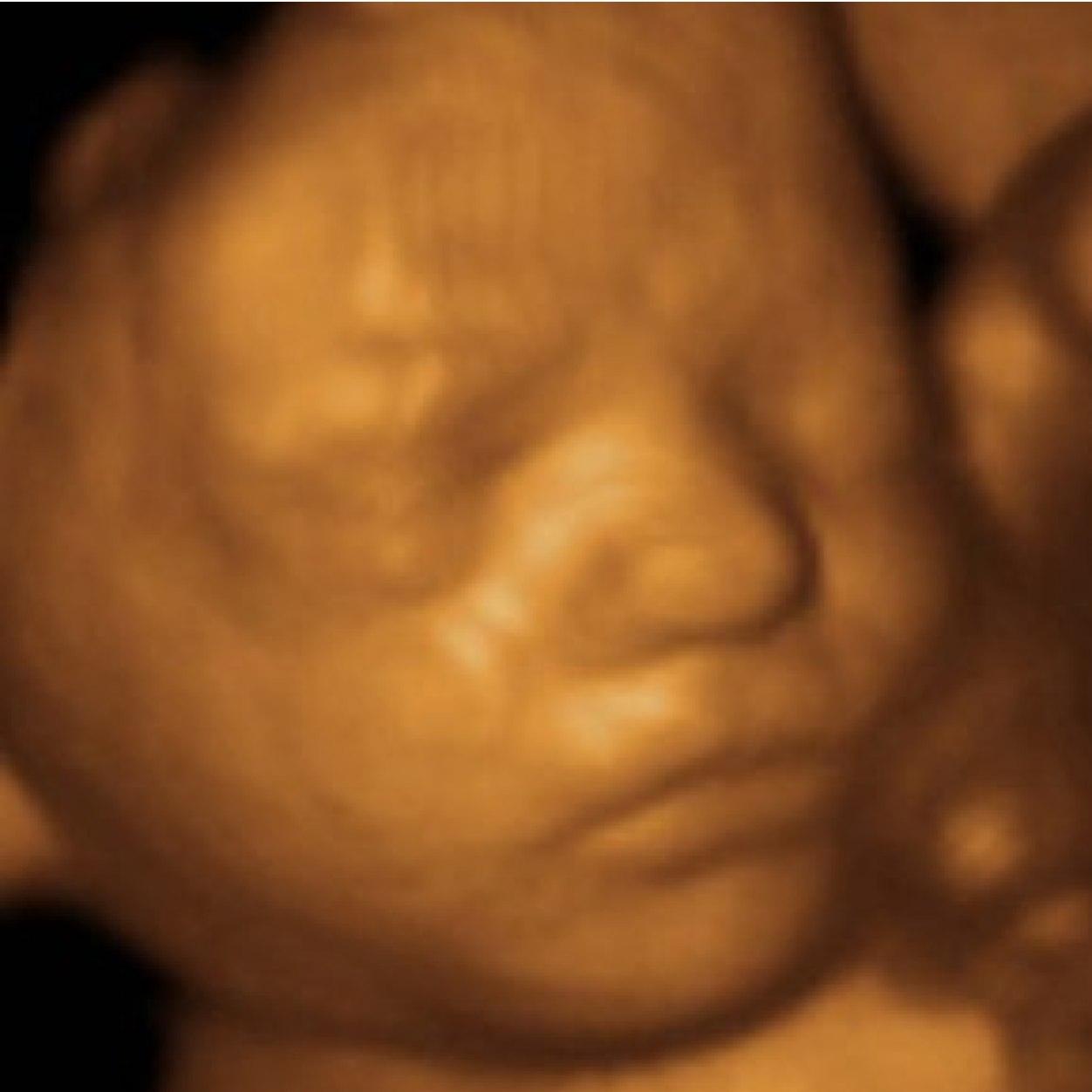 3d/4d ultrasounds. We can do gender checks too. Located in Ballwin, just 10 minutes from our previous Fenton location.