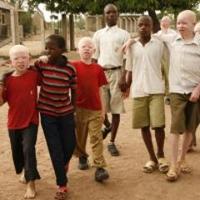 Albinism in Africa (@albinismafrica) 's Twitter Profile