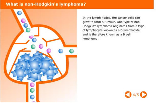 Non-Hodgkin's lymphoma (NHL) is cancer of lymphatic system, treatment for certain types of NHL is RIT