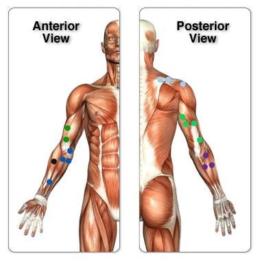 Think beyond #icepacks or traditional methods to manage pain and stiffness associated with soft tissue injuries. Try #tshellz and #arnica infusion pain cream.