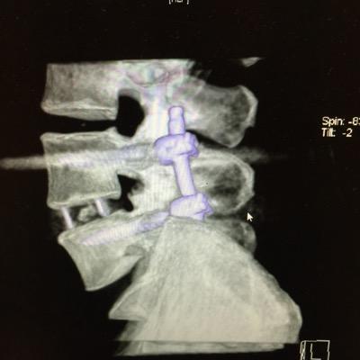 KHNeurosurgery's profile picture. Minimally Invasive Pituitary Brain & Spine Neurosurgeon. 
Husband of one, Father of two.
Supporter of EFC, MVC, Liverpool.