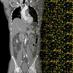 Oncology Imaging (@oncoimaging) Twitter profile photo Oncology Imaging (@oncoimaging) Twitter profile photo