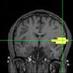 Speech Neuroscience & Biomagnetic Imaging Labs (@ucsf_snl_bil) Twitter profile photo Speech Neuroscience & Biomagnetic Imaging Labs (@ucsf_snl_bil) Twitter profile photo