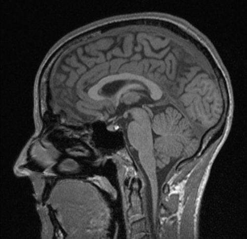 progressnotes's profile picture. Personal account, mostly retweets and stuff. Occasional radiology gems