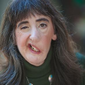 facinguptoit's profile picture. Facing Up to It author & inspirational speaker. I embrace my facial difference & help others appreciate their own qualities. Love Icelandic horses & rock music.