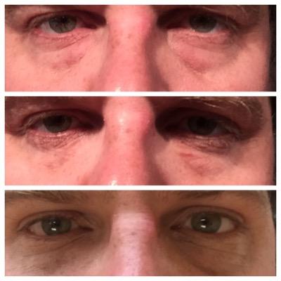 I am husband-dad-teacher-coach living in NOLA. I am selling Instantly Ageless and other skincare and anti-aging products. Check my site for more info.