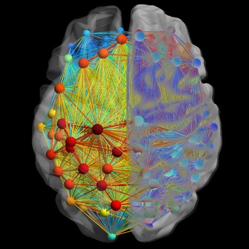 PI: Kristina Simonyan | Dystonia | Laryngeal Dystonia | Speech Production | Central Motor Control | Neuroimaging | Genetics