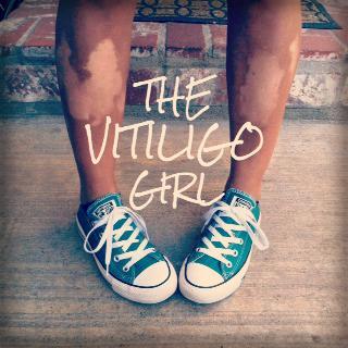 TheVitiligoGirl's profile picture. I'm a research junkie, sharing my journey to reverse my #vitiligo and inspiring others with vitiligo to be brave and improve their #health