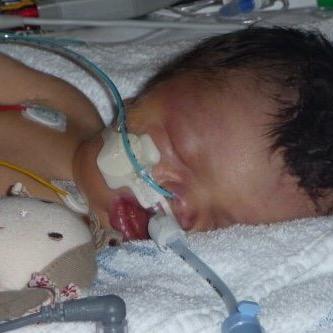 jennaleigh50's profile picture. #Smile-The Chloe Tate Foundation  Raising awareness of Congenital Diaphragmatic Hernia (CDH) in memory of our firstborn daughter Chloe, lost to CDH aged 3 days