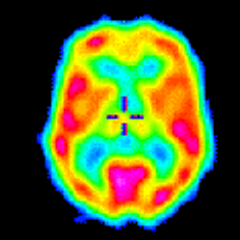 I am the original neuronbob. I just made it to Twitter late. Neurologist and car nerd.
I have never frequently used Twitter but am around episodically