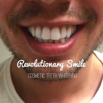 Edinburgh & The Lothians number one for Cosmetic Teeth Whitening Harley Street Trained  Lovelite Specialist 07713014006 Revolutionarysmiles@gmail.com