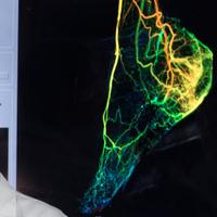 Amish Patel (@amishpatelmd) 's Twitter Profile