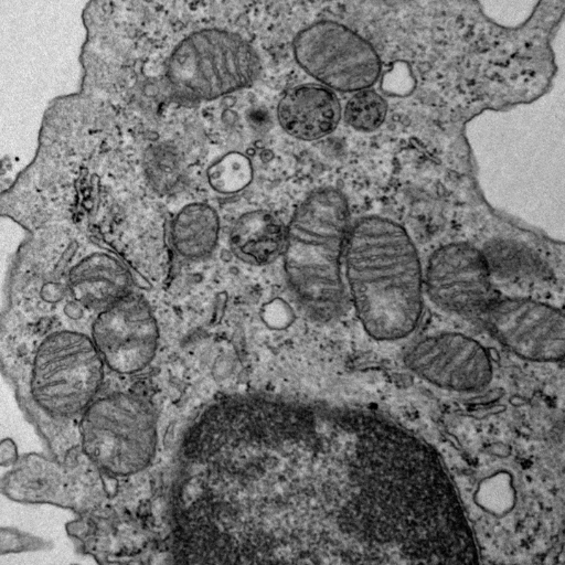 Professor of Immunology at QMUL aiming to define immune defects as we age.