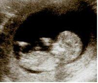 After a hashimoto's diagnosis,  3 rounds of clomid, 2 rounds of injectibles, five IUI's and one IVF I am finally pregnant and In the BabyZone!