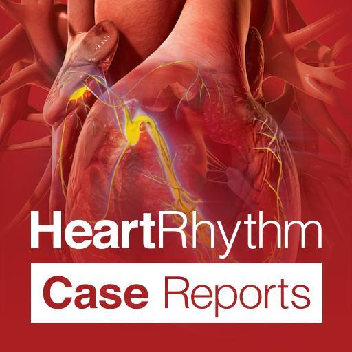 The 2nd official journal of the Heart Rhythm Society with focus on the education & treatment. A follow means a shared love of heart rhythms not an endorsement.