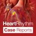 HR Case Reports (@HRS_CaseReports) Twitter profile photo