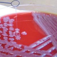 Klebsiella Papers (@klebspapers) 's Twitter Profile Photo Klebsiella Papers (@klebspapers) 's Twitter Profile Photo