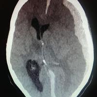 British Neurotrauma Group (@bntg_uk) 's Twitter Profile