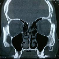 Michael Aschauer (@back_face) 's Twitter Profile