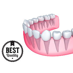 Best Reviews on Dental Implants