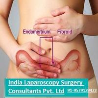 Laparoscopy Surgery India(@IndiaLaparoscop) 's Twitter Profile Photo