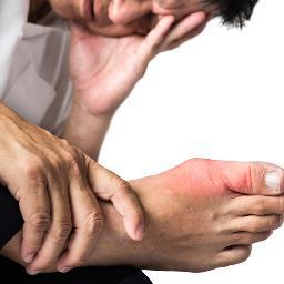 Tips for #gout and #pain #relief while connecting individuals to #clinicaltrials around the world