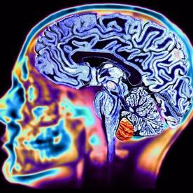 Alexmess10's profile picture. Publishing since 2012 - pronouns (win/win)