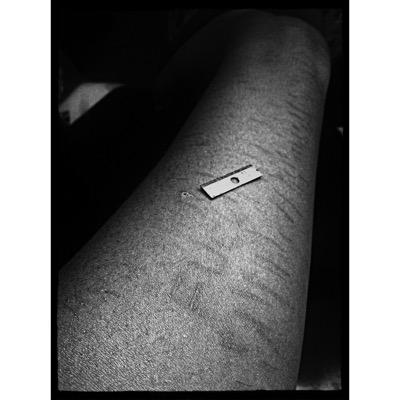 NumbParalysis_'s profile picture. a girl living with severe depression, anxiety, bpd, bulimia and suicidal thoughts. my life is one big trigger warning.