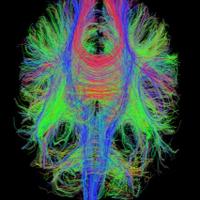 David Menon (@menon_cambridge) 's Twitter Profile Photo David Menon (@menon_cambridge) 's Twitter Profile Photo