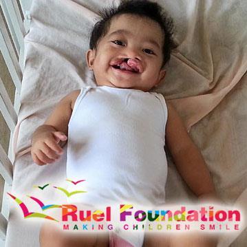 RuelFoundation's profile picture. Ruel Foundation is a faith based, humanitarian organisation that provides free medical aid to children with physical deformities