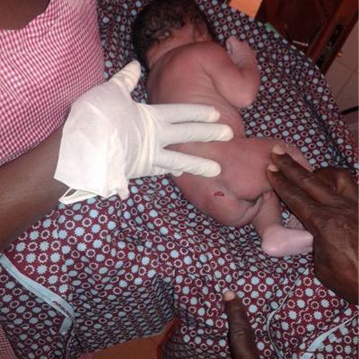 Save the people of #BurkinaFaso from the terrorist  who took over the country 3 days ago and shot this baby boy in his mother's womb. nobody is safe!RETWEET plz