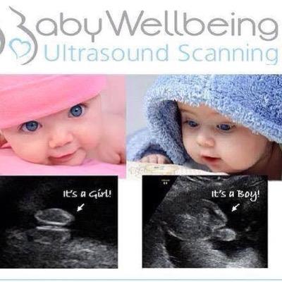 Private Ultrasound Scanning Company Specialists in 3D & 4D Imaging