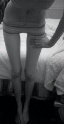 Ana= anorexia/anorexic . probably triggering. tweet me if you need someone, I'm here. Kik- merp0126