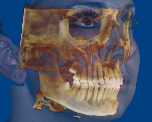 Everything you need to know about Cone Beam CT