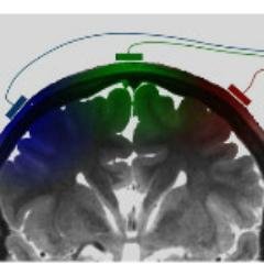 Pain research at the Institute of Neuroscience (IONS)
Université catholique de Louvain (UCL)

Read more: https://t.co/ekVSiHWcU2