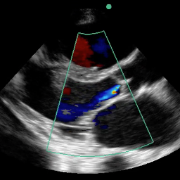 CAEP Emergency US Profile