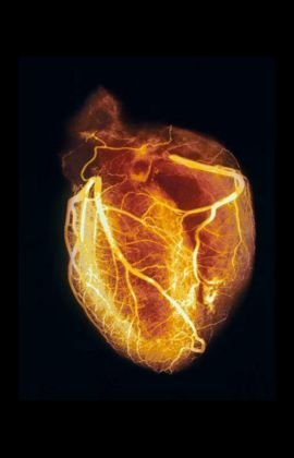 Cirujano cardiaco - Institutano de corazón. Disfruto del amor de familia. Be smarter and choose your thoughts