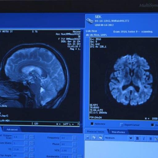 An independent documentary that follows three women at high risk for Alzheimer’s disease who offer their brains and bodies to a long term medical study.